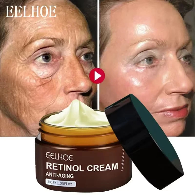 Creme Retinol da EELHOE. Anti-envelhecimento, anti-inchaço e anti-olheiras. Suaviza e clareia manchas.