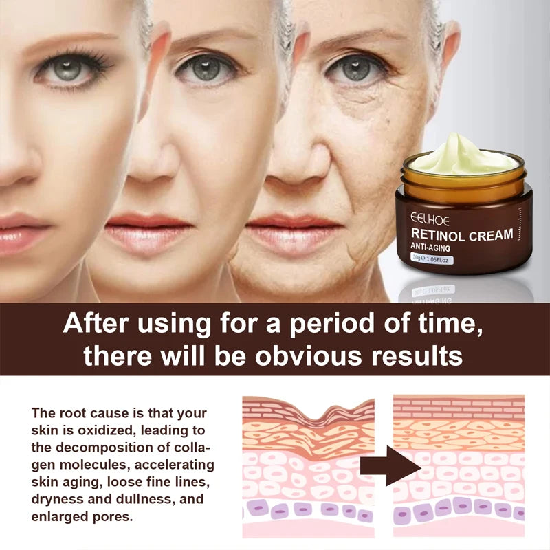Creme Retinol da EELHOE. Anti-envelhecimento, anti-inchaço e anti-olheiras. Suaviza e clareia manchas.