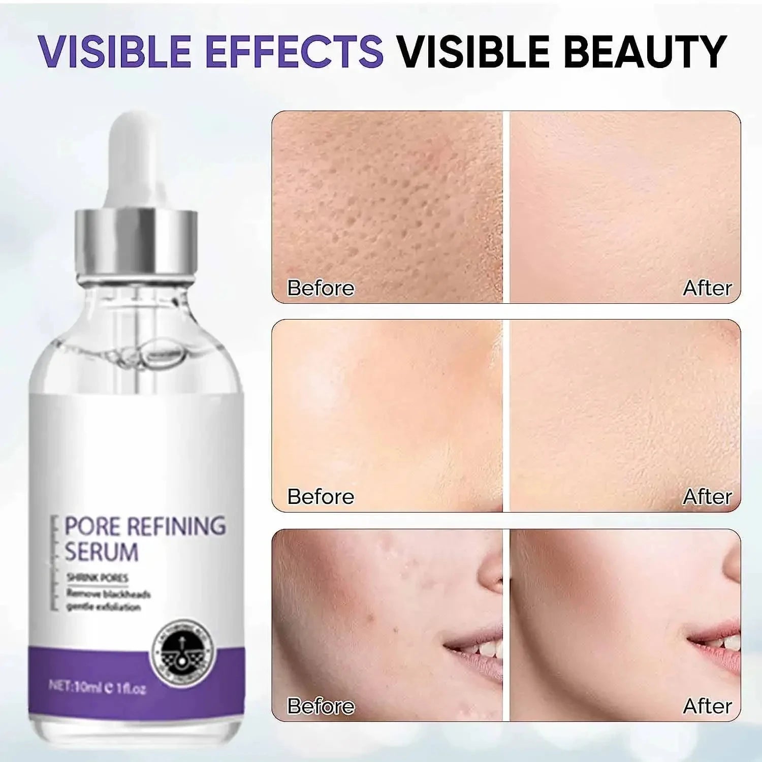 Soro de encolhimento de poros, remoção facial de poros grandes, reparação de poros grandes, creme minimizador de poros faciais