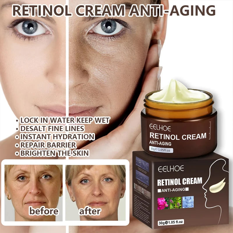 Creme Retinol da EELHOE. Anti-envelhecimento, anti-inchaço e anti-olheiras. Suaviza e clareia manchas.