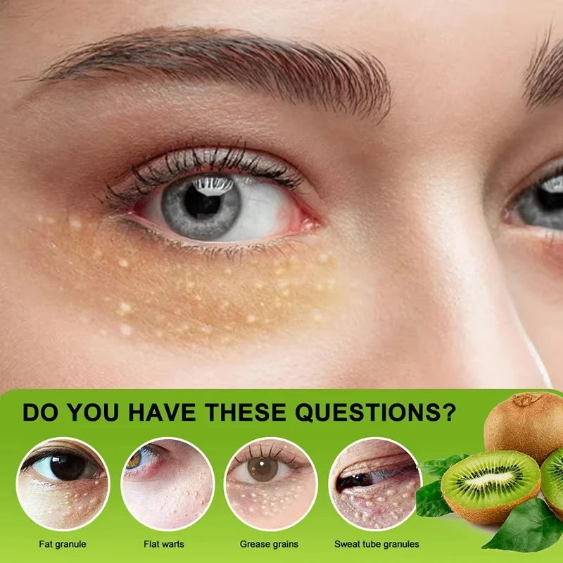 Creme para remoção de grânulos de gordura , ação delicada na área dos olhos