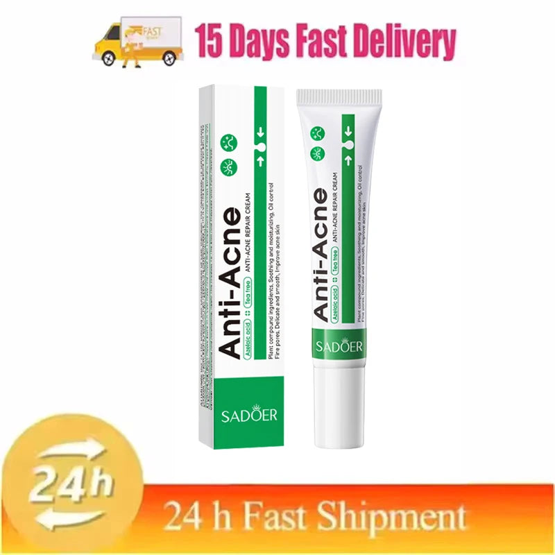 Pomada para tratamento de acne, reparação de manchas de espinhas, faz limpeza profunda dos poros. Poderoso anti-acne cicatrizante.
