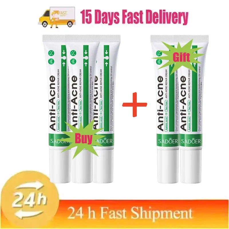 Pomada para tratamento de acne, reparação de manchas de espinhas, faz limpeza profunda dos poros. Poderoso anti-acne cicatrizante.
