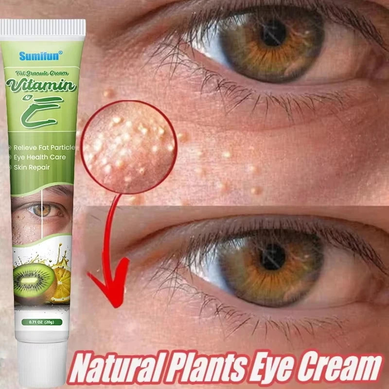 Creme para remoção de grânulos de gordura , ação delicada na área dos olhos