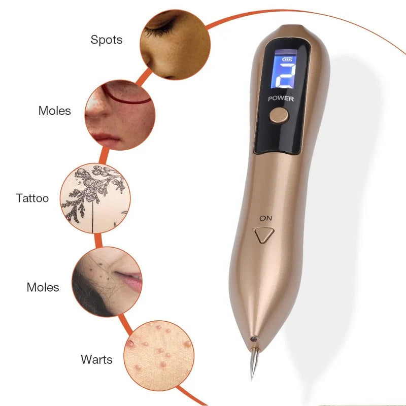 Caneta a Laser que remove manchas escuras, sardas, verrugas e até tatuagem
