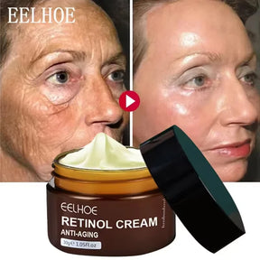 Creme Retinol da EELHOE. Anti-envelhecimento, anti-inchaço e anti-olheiras. Suaviza e clareia manchas.