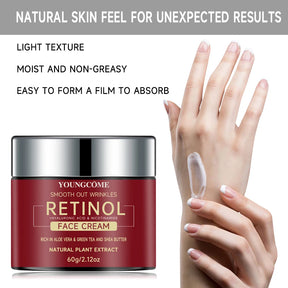 Creme Facial Youngcôme com Retinol, Ácido Hialurônico e Niacinamida – Antissinais, Anti-envelhecimento e Hidratação Profunda