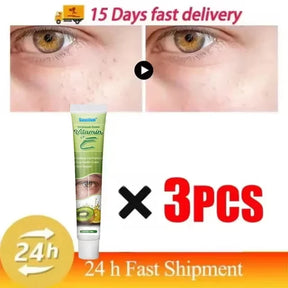 Creme para remoção de grânulos de gordura , ação delicada na área dos olhos