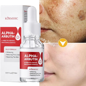 Removedor Coreano de manchas escuras, clareador de pele, sardas faciais, melanina, correção e redução de linhas finas.