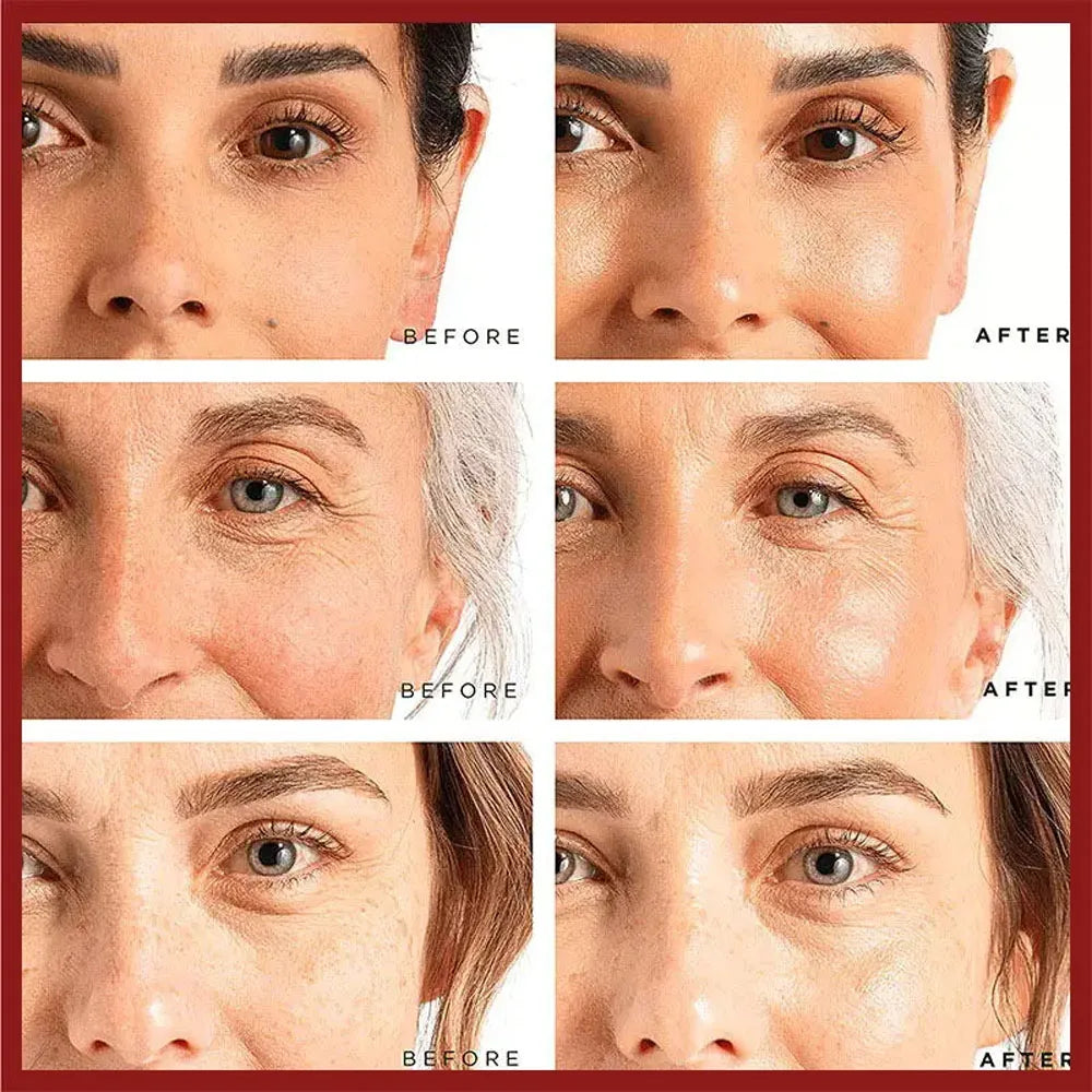 Creme Retinol da EELHOE. Anti-envelhecimento, anti-inchaço e anti-olheiras. Suaviza e clareia manchas.