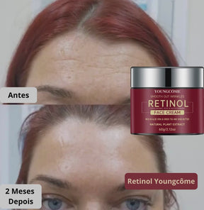 Retinol Youngcôme Original Coreano – Reduz Rugas, Linhas e Uniformiza a Pele