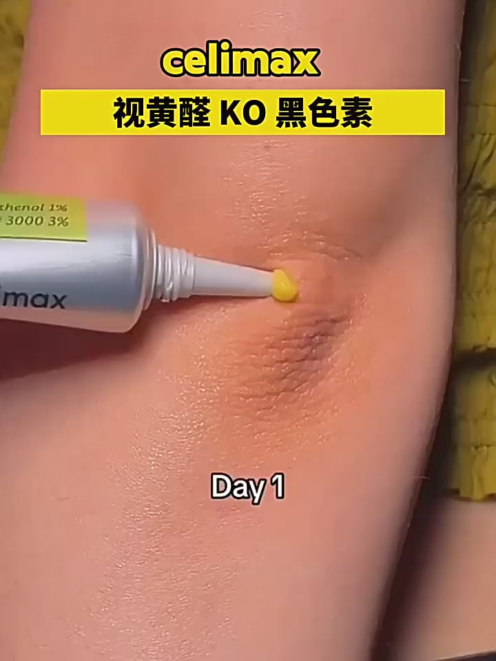 Retinal Celimax - Pele Mais Lisa, Firme e Jovem em Poucas Semanas